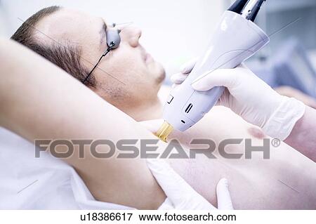 Stock Photo - Man getting laser hair removal treatment for under arms.. Fotosearch