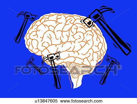 Migraine, conceptual illustration. View Large Photo Image Stock Photography - Migraine, conceptual illustration.. Fotosearch
