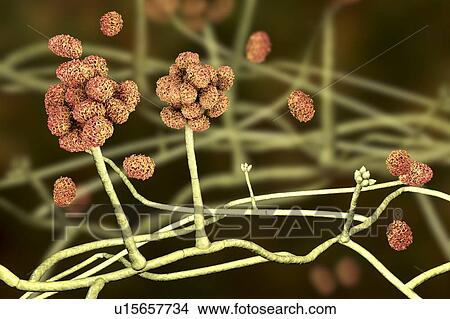 Picture - Stachybotrys sp. fruiting structure with spores, computer illustration. Often known as the toxic mould (black mould). Several strains of this fungus (S. atra, S. chartarum and S. alternans) are synonymous. This fungus may produce a trichothecene.... Fotosearch