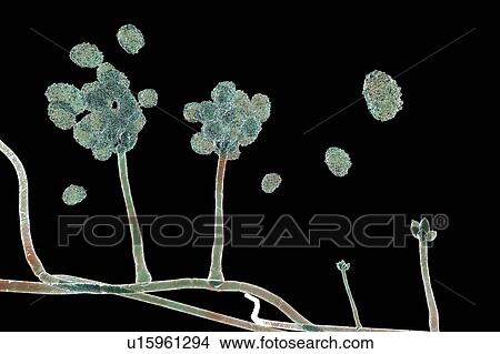 Picture - Stachybotrys sp. fruiting structure with spores, computer illustration. Often known as the toxic mould (black mould). Several strains of this fungus (S. atra, S. chartarum and S. alternans) are synonymous. This fungus may produce a trichothecene.... Fotosearch