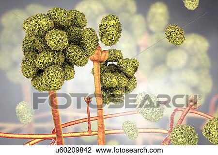 Stachybotrys sp. fruiting structure with spores, computer illustration. Often known as the toxic mould (black mould). Several strains of this fungus (S. atra, S. chartarum and S. alternans) are synonymous. This fungus may produce a trichothecene... View Large Photo Image Stock Image - Stachybotrys sp. fruiting structure with spores, computer illustration. Often known as the toxic mould (black mould). Several strains of this fungus (S. atra, S. chartarum and S. alternans) are synonymous. This fungus may produce a trichothecene.... Fotosearch