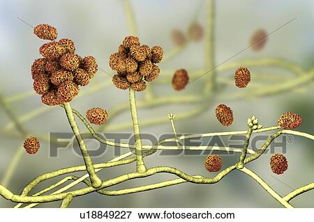 Stock Photo - Stachybotrys sp. fruiting structure with spores, computer illustration. Often known as the toxic mould (black mould). Several strains of this fungus (S. atra, S. chartarum and S. alternans) are synonymous. This fungus may produce a trichothecene.... Fotosearch