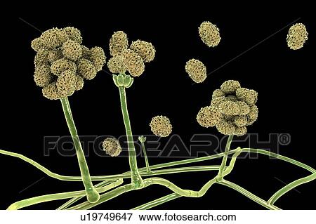 Stock Photo - Stachybotrys sp. fruiting structure with spores, computer illustration. Often known as the toxic mould (black mould). Several strains of this fungus (S. atra, S. chartarum and S. alternans) are synonymous. This fungus may produce a trichothecene.... Fotosearch