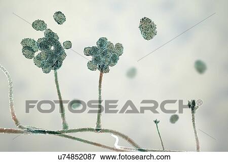 Stock Photo - Stachybotrys sp. fruiting structure with spores, computer illustration. Often known as the toxic mould (black mould). Several strains of this fungus (S. atra, S. chartarum and S. alternans) are synonymous. This fungus may produce a trichothecene.... Fotosearch