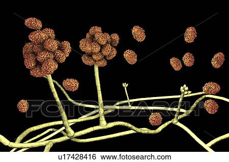 Stock Photograph - Stachybotrys sp. fruiting structure with spores, computer illustration. Often known as the toxic mould (black mould). Several strains of this fungus (S. atra, S. chartarum and S. alternans) are synonymous. This fungus may produce a trichothecene.... Fotosearch