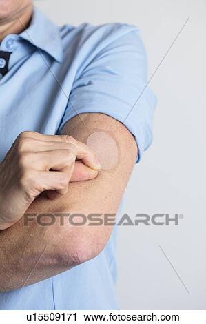 Stock Image - Woman applying a hormone replacement therapy (HRT) patch to her arm. This transdermal patch slowly administers the hormone oestrogen into the bloodstream. Oestrogen replacement therapy is typically given to relieve menopausal symptoms in women.. Fotosearch