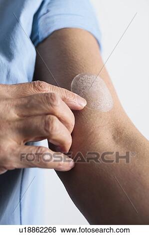 Stock Photograph - Woman applying a hormone replacement therapy (HRT) patch to her arm. This transdermal patch slowly administers the hormone oestrogen into the bloodstream. Oestrogen replacement therapy is typically given to relieve menopausal symptoms in women.. Fotosearch