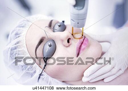 Young woman having laser hair removal treatment on face, close-up. View Large Photo Image Stock Photo - Young woman having laser hair removal treatment on face, close-up.. Fotosearch
