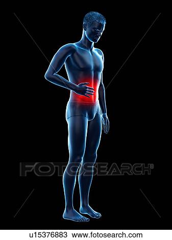 Stock Image - Abdominal pain, conceptual illustration.. Fotosearch