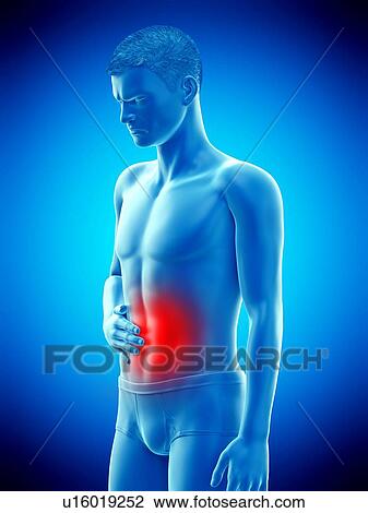 Stock Image - Abdominal pain, conceptual illustration.. Fotosearch