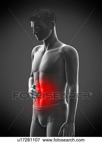 Stock Photo - Abdominal pain, conceptual illustration.. Fotosearch