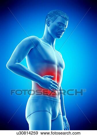 Stock Photo - Abdominal pain, conceptual illustration.. Fotosearch
