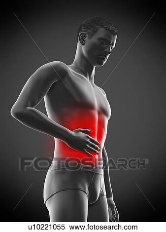 Stock Photography - Abdominal pain, conceptual illustration.. Fotosearch