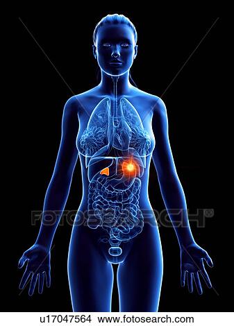 Picture - Adrenal glands, computer illustration. cancer. Fotosearch