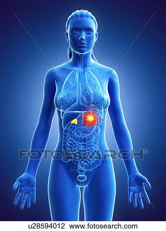 Stock Image - Adrenal glands, computer illustration. cancer. Fotosearch