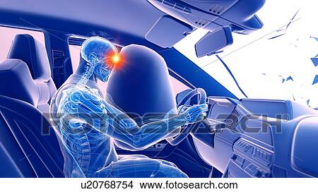 Picture - Airbag deployed in car crash, computer illustration.. Fotosearch