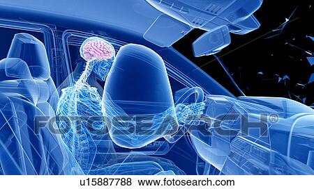 Stock Photo - Airbag deployed in car crash, computer illustration.. Fotosearch