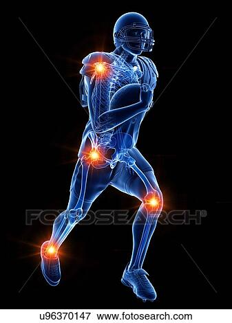 Stock Photo - American football player with painful joints, illustration. Fotosearch