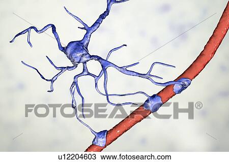 Stock Image - Astrocyte and blood vessel, computer illustration. Astrocytes, brain glial cells, also known as astroglia, connect neuronal cells to blood vessels and provide blood brain barrier.. Fotosearch