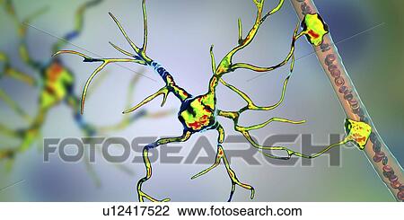 Stock Image - Astrocyte and blood vessel, computer illustration. Astrocytes, brain glial cells, also known as astroglia, connect neuronal cells to blood vessels and provide blood brain barrier.. Fotosearch