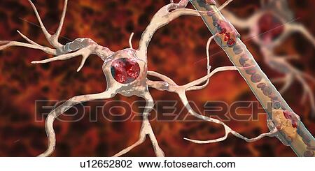 Stock Image - Astrocyte and blood vessel, computer illustration. Astrocytes, brain glial cells, also known as astroglia, connect neuronal cells to blood vessels and provide blood brain barrier.. Fotosearch