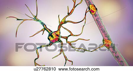Astrocyte and blood vessel, computer illustration. Astrocytes, brain glial cells, also known as astroglia, connect neuronal cells to blood vessels and provide blood brain barrier. View Large Photo Image Stock Image - Astrocyte and blood vessel, computer illustration. Astrocytes, brain glial cells, also known as astroglia, connect neuronal cells to blood vessels and provide blood brain barrier.. Fotosearch