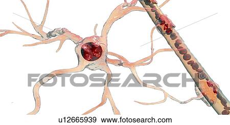 Astrocyte and blood vessel, computer illustration. Astrocytes, brain glial cells, also known as astroglia, connect neuronal cells to blood vessels and provide blood brain barrier. View Large Photo Image Stock Photo - Astrocyte and blood vessel, computer illustration. Astrocytes, brain glial cells, also known as astroglia, connect neuronal cells to blood vessels and provide blood brain barrier.. Fotosearch