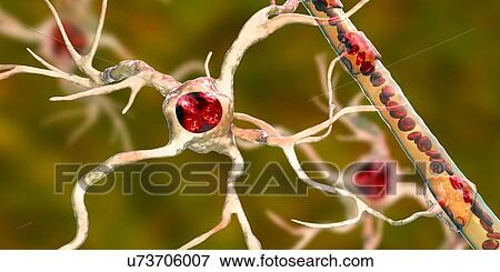 Stock Photo - Astrocyte and blood vessel, computer illustration. Astrocytes, brain glial cells, also known as astroglia, connect neuronal cells to blood vessels and provide blood brain barrier.. Fotosearch