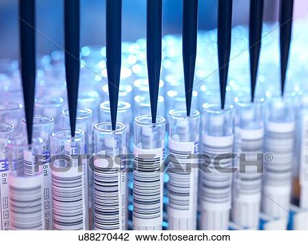 Stock Image - Automated blood sample testing in laboratory for healthcare screening.. Fotosearch