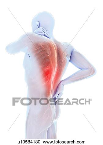Stock Image - Back pain, computer illustration.. Fotosearch