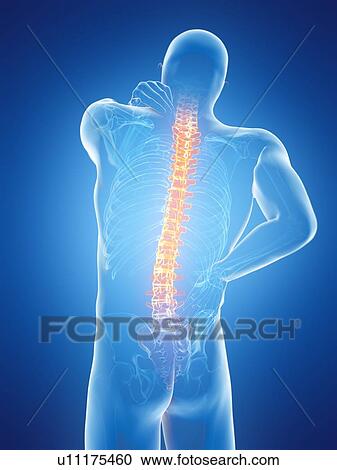 Back pain, computer illustration. View Large Photo Image Stock Image - Back pain, computer illustration.. Fotosearch