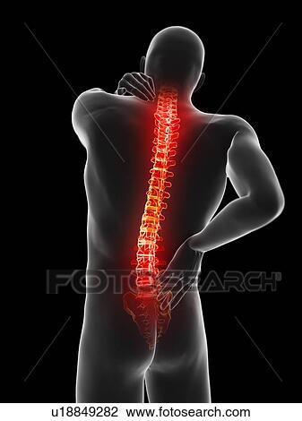 Stock Image - Back pain, computer illustration.. Fotosearch