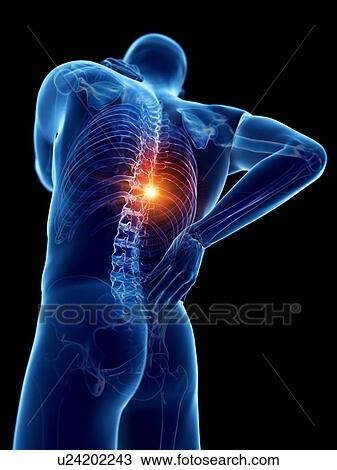 Stock Image - Back pain, computer illustration.. Fotosearch