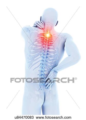 Stock Image - Back pain, computer illustration.. Fotosearch