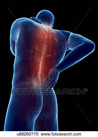 Stock Image - Back pain, computer illustration.. Fotosearch