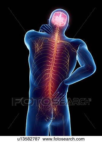 Back pain, computer illustration. View Large Photo Image Stock Photo - Back pain, computer illustration.. Fotosearch