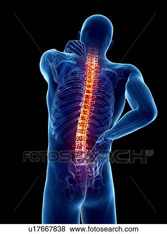 Back pain, computer illustration. View Large Photo Image Stock Photo - Back pain, computer illustration.. Fotosearch