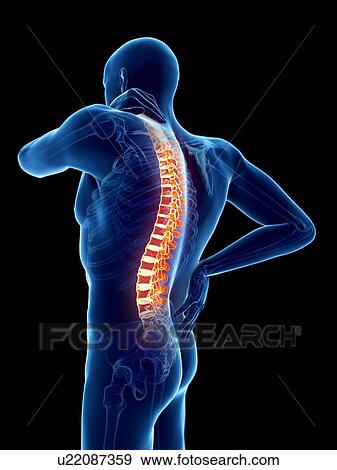 Back pain, computer illustration. View Large Photo Image Stock Photo - Back pain, computer illustration.. Fotosearch