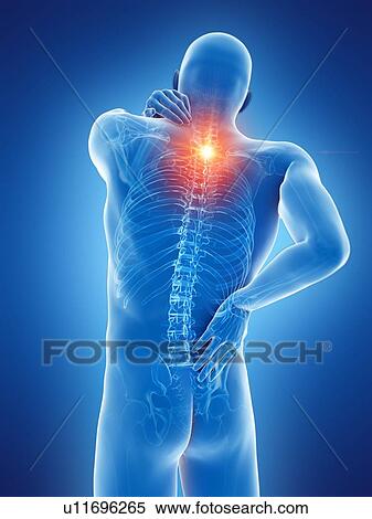 Back pain, computer illustration. View Large Photo Image Stock Photography - Back pain, computer illustration.. Fotosearch