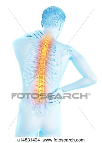 Back pain, conceptual illustration. View Large Photo Image Picture - Back pain, conceptual illustration.. Fotosearch