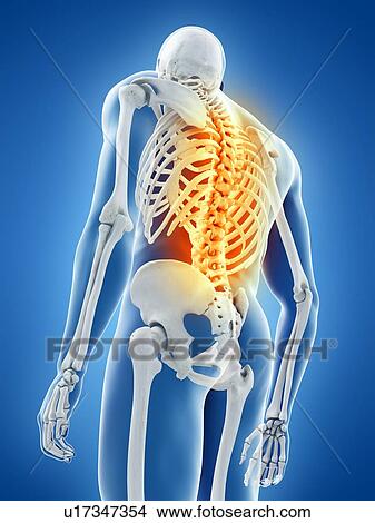 Back pain, conceptual illustration View Large Photo Image Picture - Back pain, conceptual illustration. Fotosearch