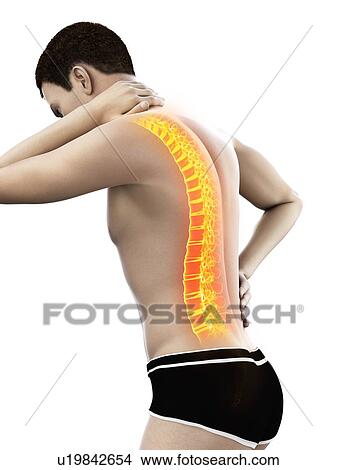 Picture - Back pain, conceptual illustration.. Fotosearch