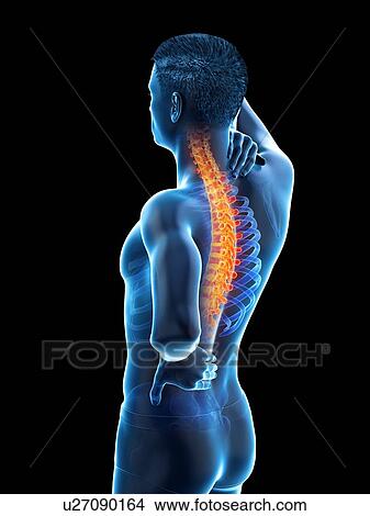 Picture - Back pain, conceptual illustration.. Fotosearch