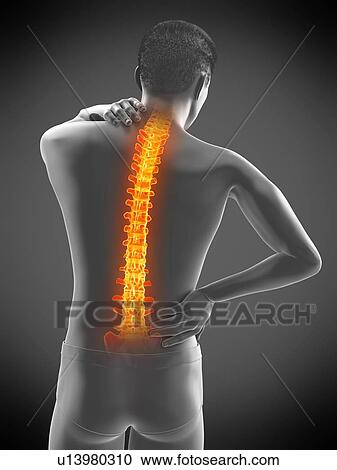 Stock Image - Back pain, conceptual illustration.. Fotosearch