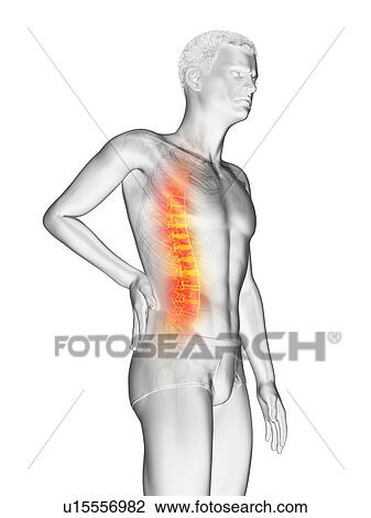 Back pain, conceptual illustration. View Large Photo Image Stock Image - Back pain, conceptual illustration.. Fotosearch