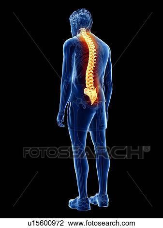 Back pain, conceptual illustration View Large Photo Image Stock Image - Back pain, conceptual illustration. Fotosearch