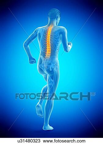 Stock Image - Back pain, conceptual illustration.. Fotosearch