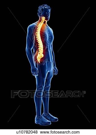 Stock Photo - Back pain, conceptual illustration. Fotosearch