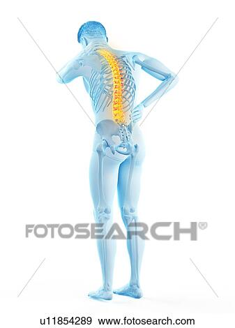Back pain, conceptual illustration. View Large Photo Image Stock Photo - Back pain, conceptual illustration.. Fotosearch