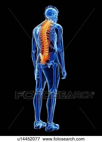 Back pain, conceptual illustration View Large Photo Image Stock Photo - Back pain, conceptual illustration. Fotosearch